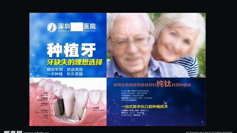 烤瓷牙加工厂合作，如何选择合适的方式？**